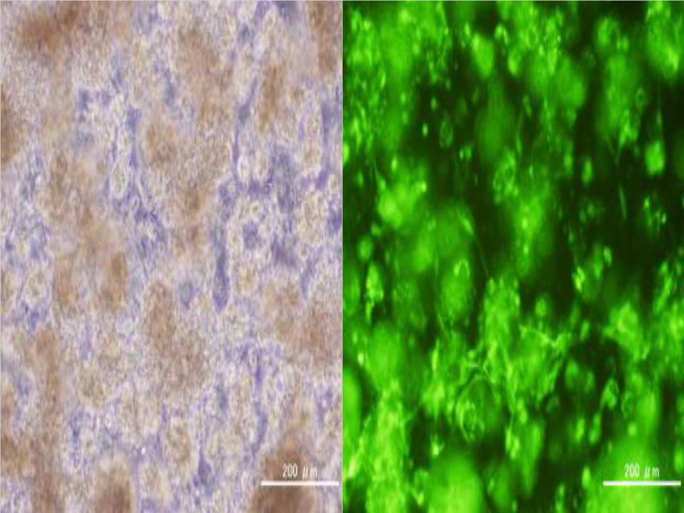 Neurospheres - Neural Stem cells Derived from Mouse SVZ - 24 hours after electroporation